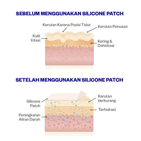 Hand Wrinkle Patch PACK